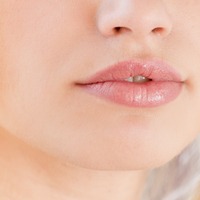 Plump lips The Ottawa Clinic 2