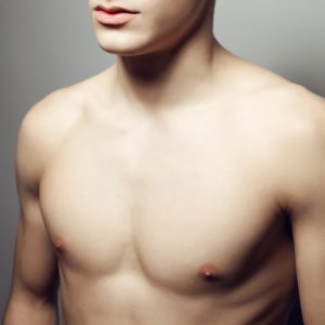 Gynecomastia