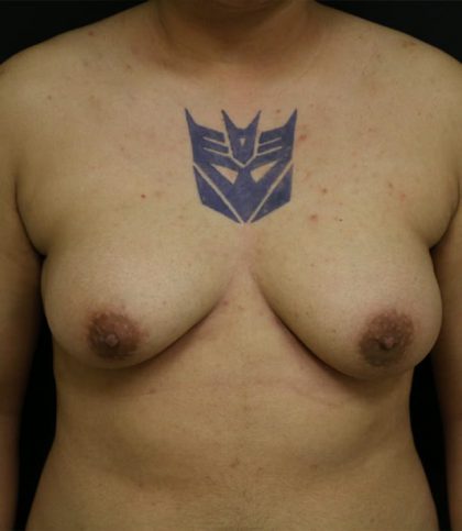 Before Image