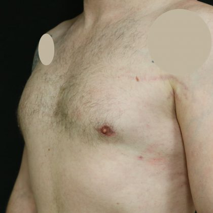 After Image